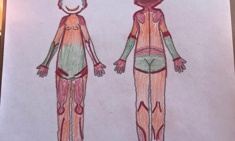 Fibromialgia: Historias que Sanan